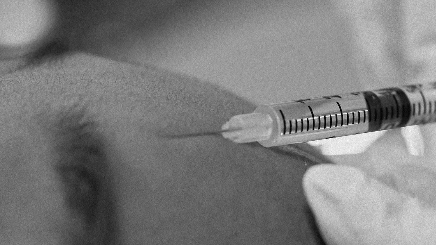 6 Questions To Ask Yourself Before Getting Botox