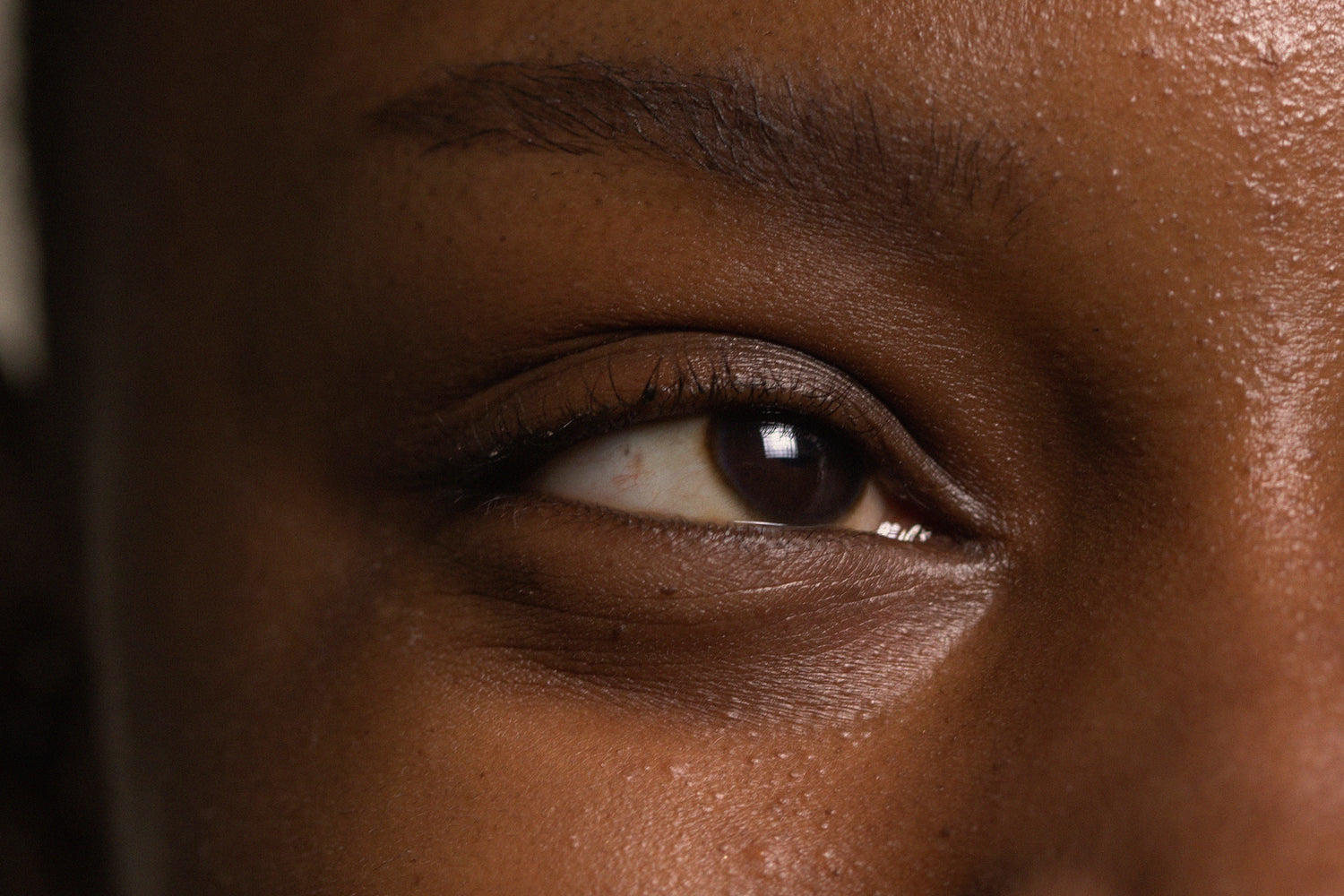 How To Reduce Dark Circles