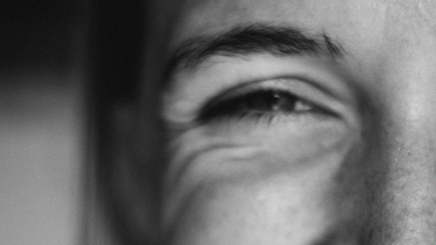 How To Treat Under-Eye Wrinkles & Crows Feet