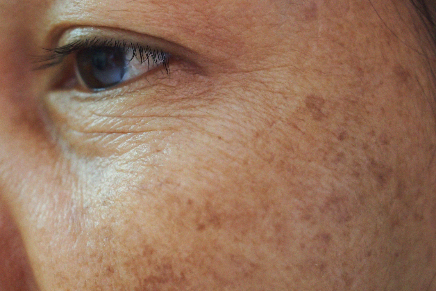 Debunking the Top 6 Myths on Pigmentation