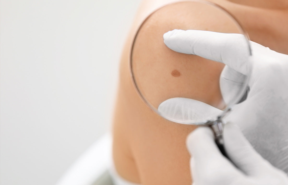 The Ugly Duckling Rule: Sun-Safe Skin Secrets to Know