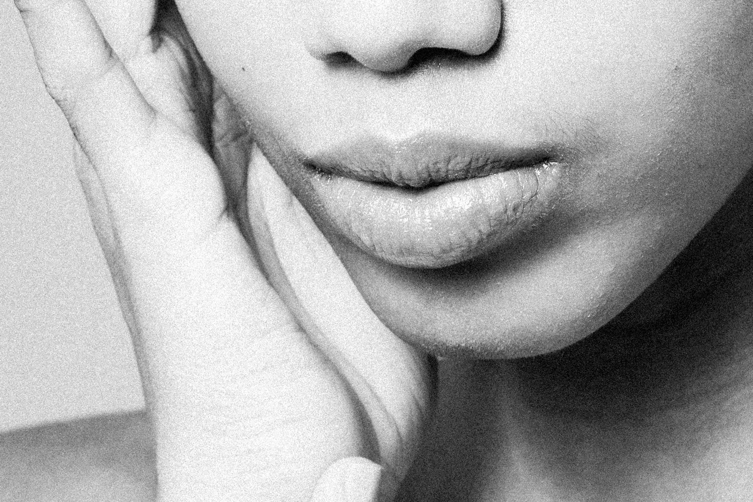 Retinoids and the Lips