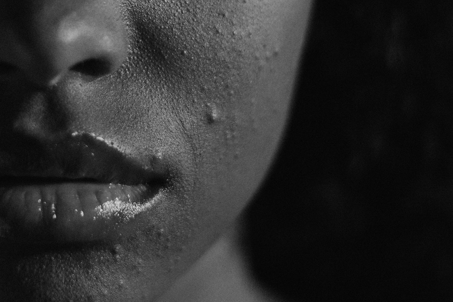 Debunking the Top 6 Acne Myths