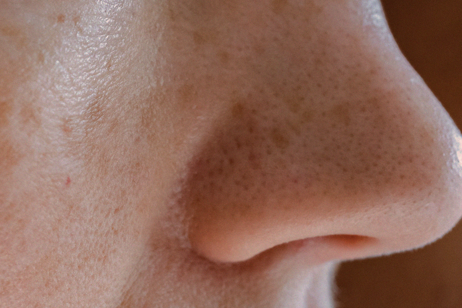 Big Pores and Procedures - How Far Should We Go?