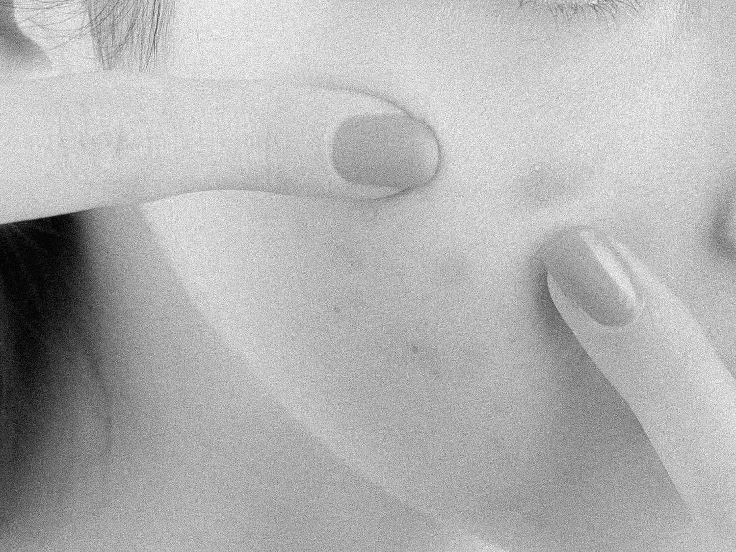 The 6 Commonest Mistakes I See In Acne Treatment