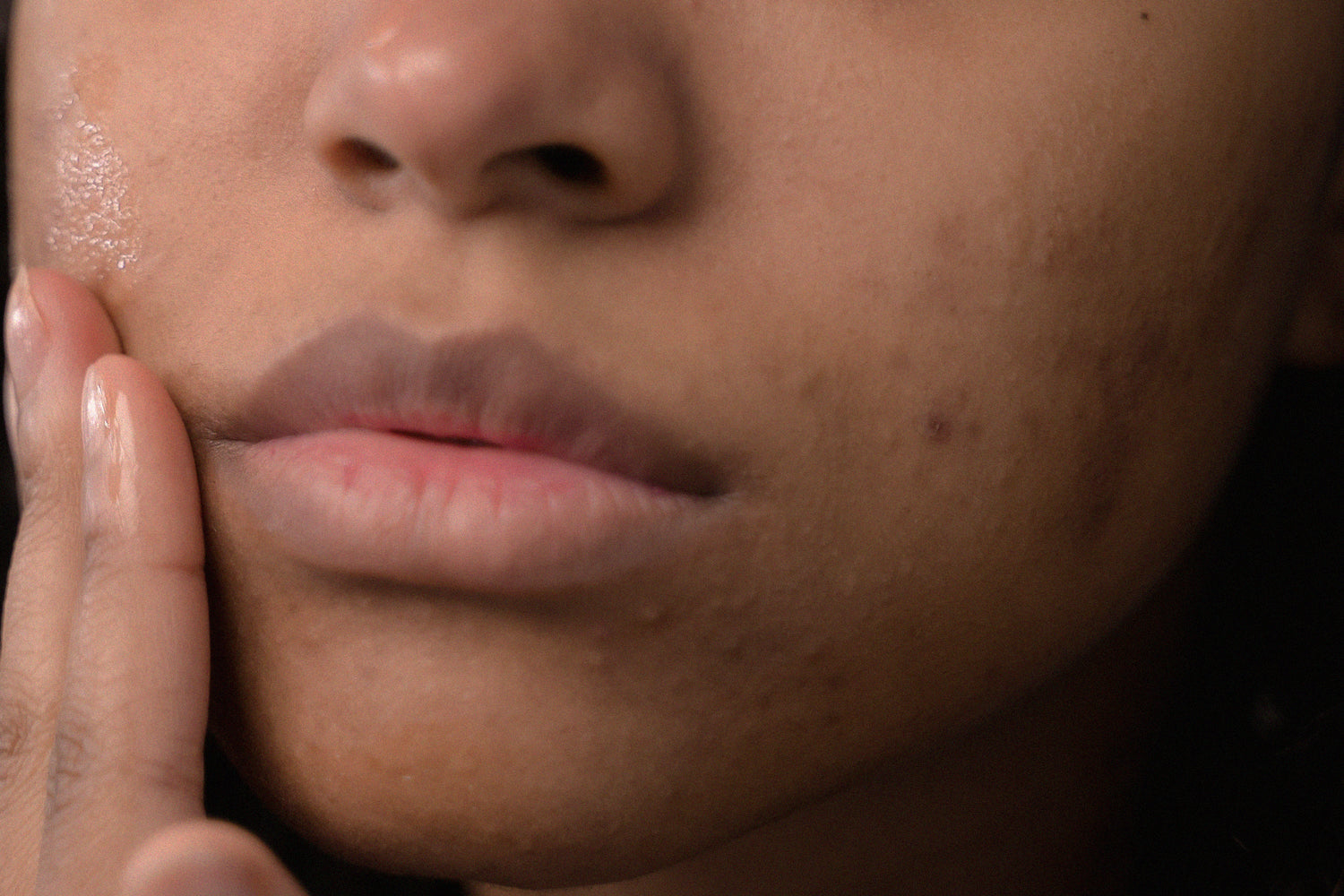 Hormones + Our Skin - Decade by Decade!