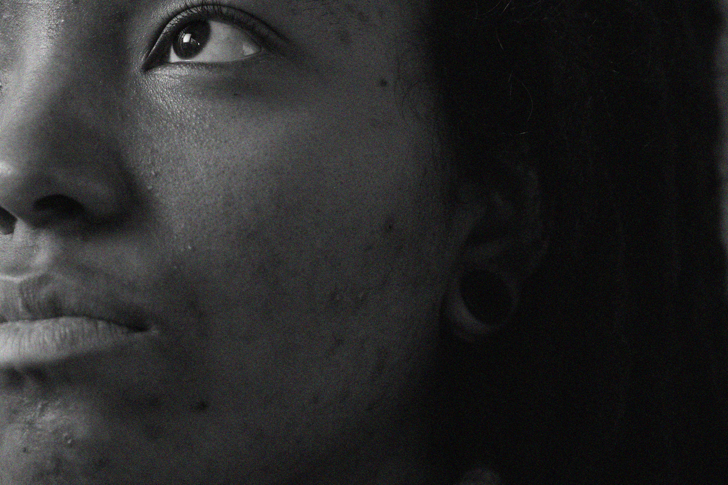 How To Use An Acne Spot Treatment The RIGHT Way!