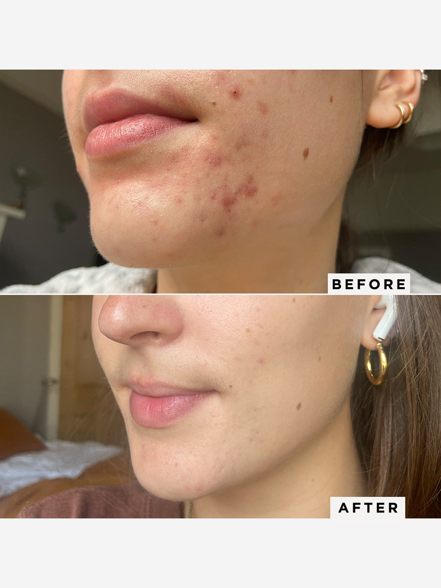 Flawless Neutralising Gel