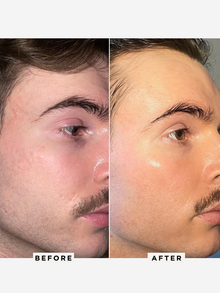 Flawless Nightly Pro 5% Retinoid Serum