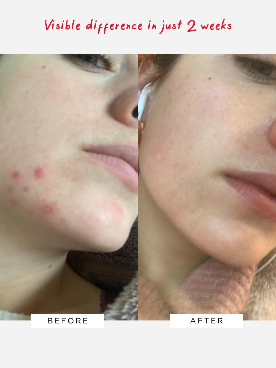 Flawless Nightly Pro 5% Retinoid Serum