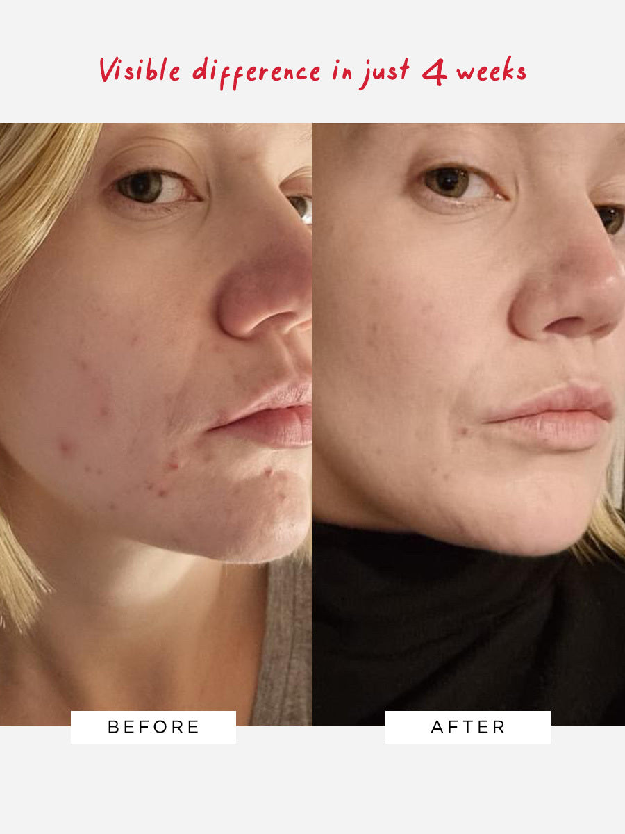 Dr Sam's Flawless Neutralising Gel Visible Results In Just 4 Weeks