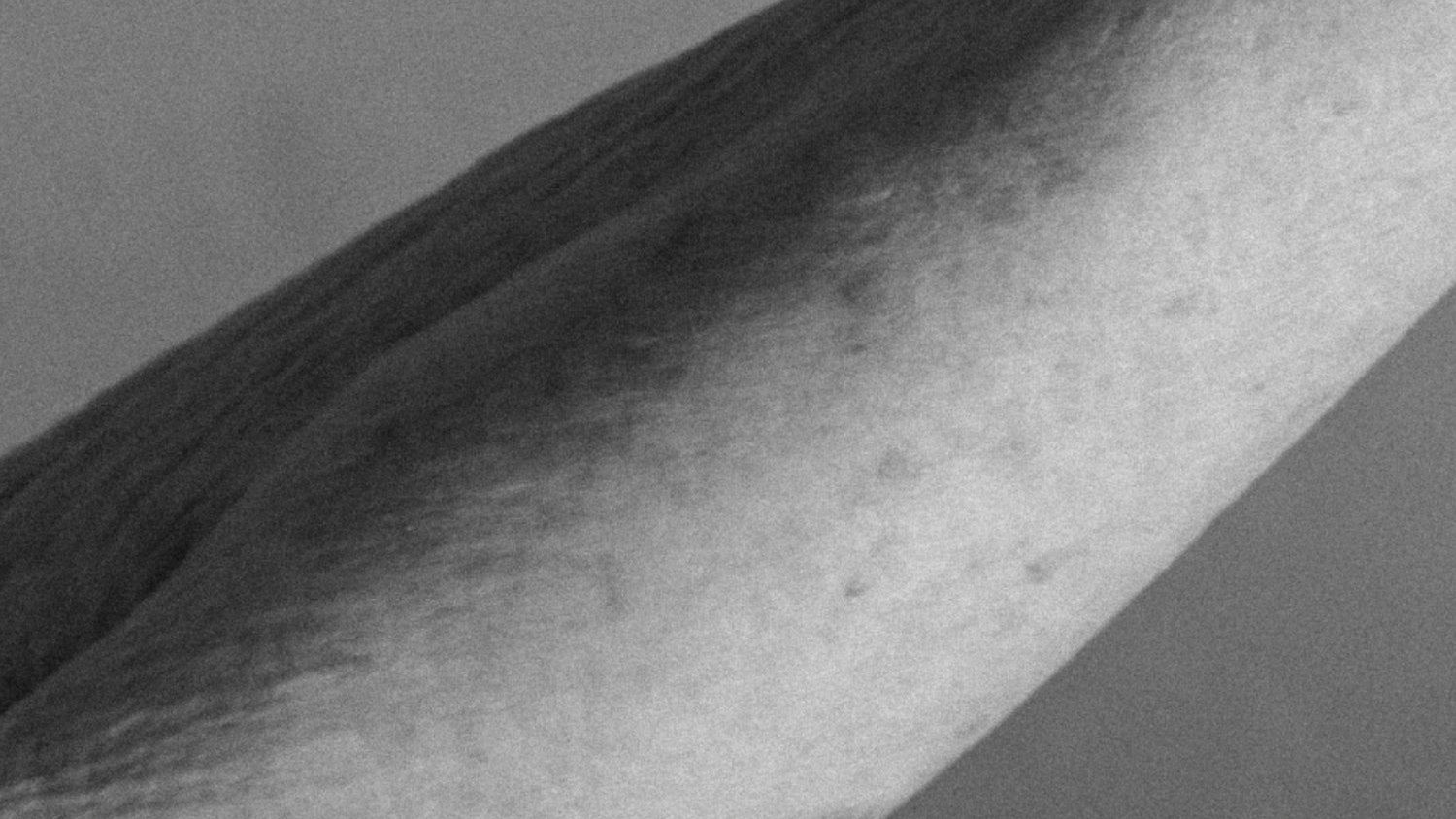 How To Repair Crepey Skin