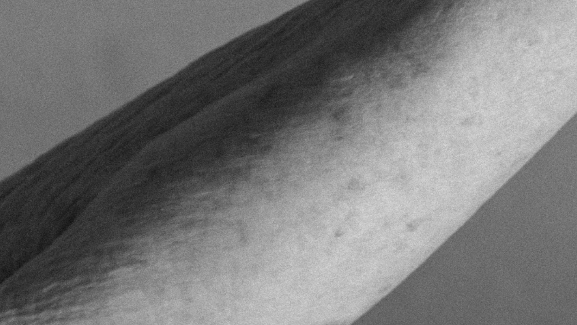 How To Repair Crepey Skin