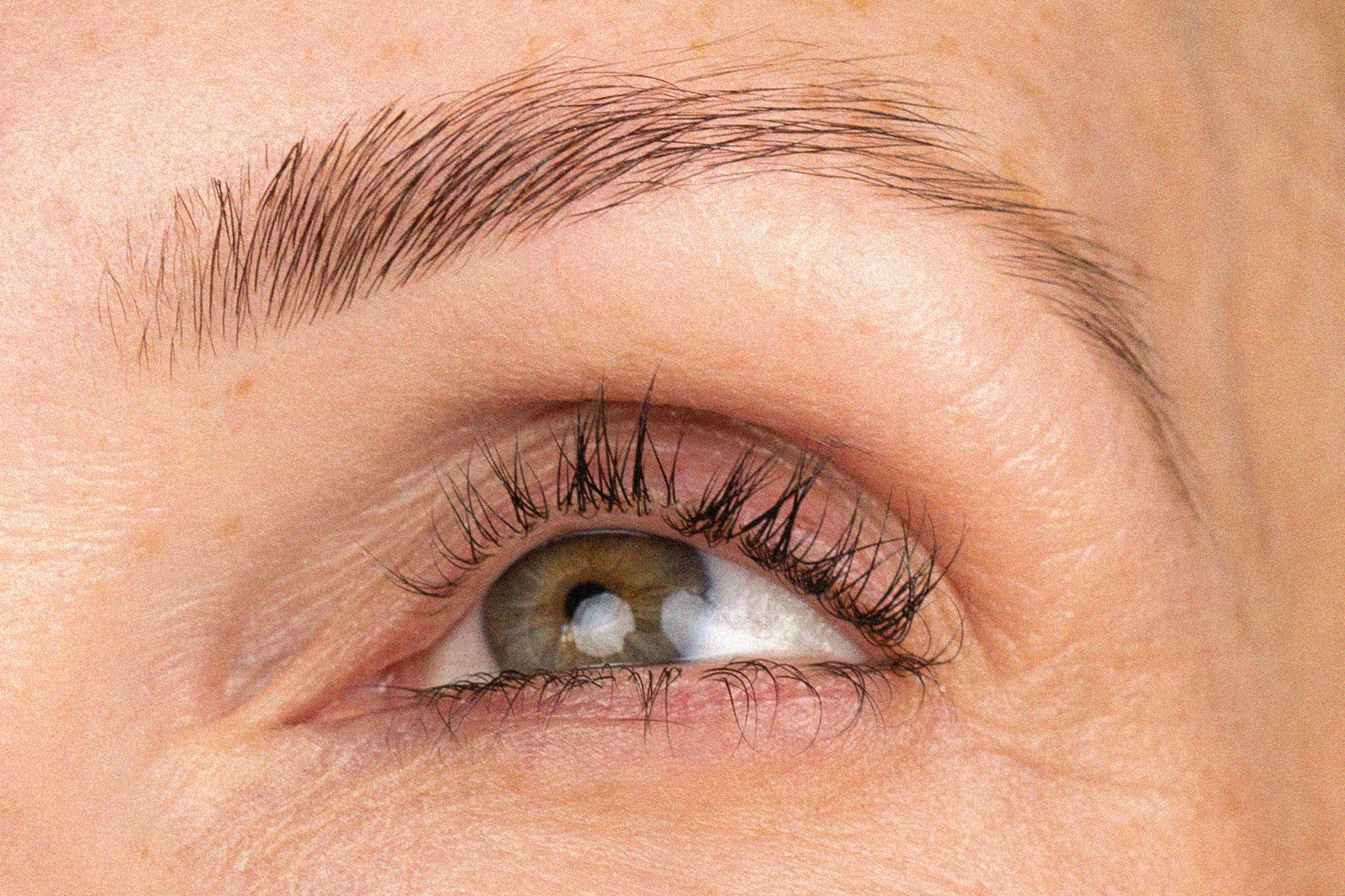 How To Look After Your Eye Area