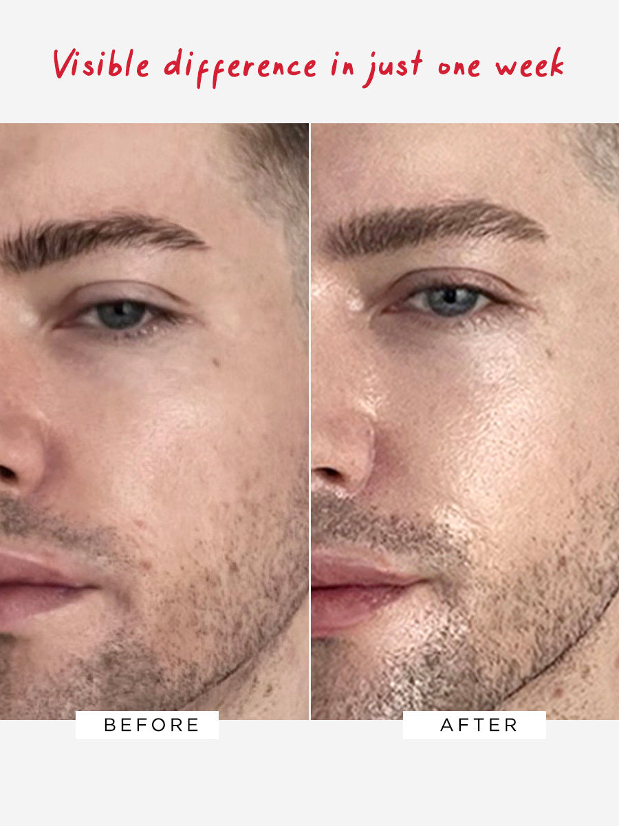 Flawless Moisturiser Intense